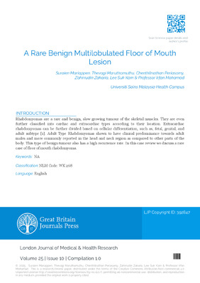 A Rare Benign Multilobulated Floor of Mouth Lesion
